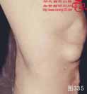 血管瘤病理图片图321-图340(图14)