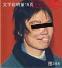 血管瘤病理图片图341-图360(图4)