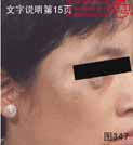 血管瘤病理图片图341-图360(图7)