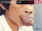 血管瘤病理图片图341-图360(图18)