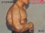 血管瘤病理图片图361-图380(图7)