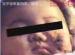 血管瘤病理图片图381-图400(图5)