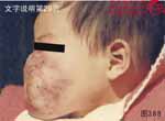 血管瘤病理图片图381-图400(图7)