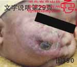 血管瘤病理图片图381-图400(图9)