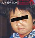 血管瘤病理图片图381-图400(图14)
