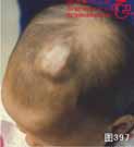 血管瘤病理图片图381-图400(图16)