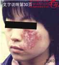 血管瘤病理图片图401-图420(图6)