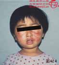 血管瘤病理图片图421-图440(图4)
