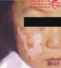 血管瘤病理图片图421-图440(图5)