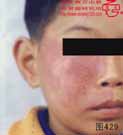 血管瘤病理图片图421-图440(图9)