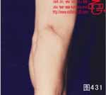 血管瘤病理图片图421-图440(图11)