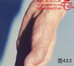 血管瘤病理图片图421-图440(图13)
