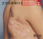血管瘤病理图片图421-图440(图15)