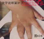 血管瘤病理图片图421-图440(图16)