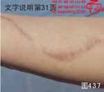 血管瘤病理图片图421-图440(图17)