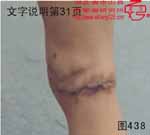 血管瘤病理图片图421-图440(图18)