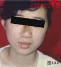 血管瘤病理图片图441-图460(图4)