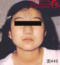 血管瘤病理图片图441-图460(图3)