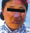 血管瘤病理图片图441-图460(图6)