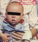 血管瘤病理图片图441-图460(图7)