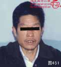 血管瘤病理图片图441-图460(图11)