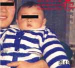 血管瘤病理图片图441-图460(图19)