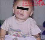 血管瘤病理图片图461-图480(图1)