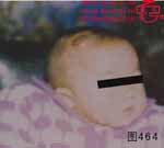 血管瘤病理图片图461-图480(图3)