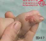 血管瘤病理图片图461-图480(图6)