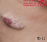 血管瘤病理图片图461-图480(图8)