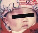 血管瘤病理图片图461-图480(图9)