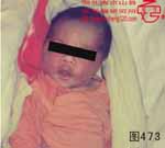 血管瘤病理图片图461-图480(图12)