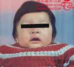 血管瘤病理图片图461-图480(图11)