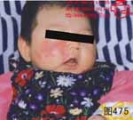 血管瘤病理图片图461-图480(图14)
