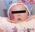 血管瘤病理图片图461-图480(图15)