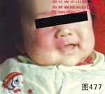 血管瘤病理图片图461-图480(图16)
