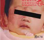 血管瘤病理图片图461-图480(图17)