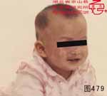 血管瘤病理图片图461-图480(图18)