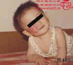 血管瘤病理图片图461-图480(图19)