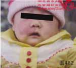 血管瘤病理图片图481-图500(图1)