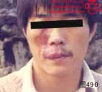 血管瘤病理图片图481-图500(图9)