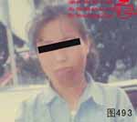 血管瘤病理图片图481-图500(图12)