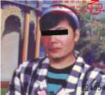 血管瘤病理图片图481-图500(图14)