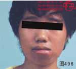 血管瘤病理图片图481-图500(图15)