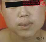 血管瘤病理图片图481-图500(图17)