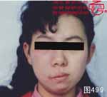 血管瘤病理图片图481-图500(图18)