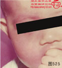 血管瘤病理图片图521-图540(图3)
