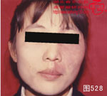 血管瘤病理图片图521-图540(图8)