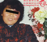 血管瘤病理图片图521-图540(图9)