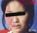 血管瘤病理图片图521-图540(图15)